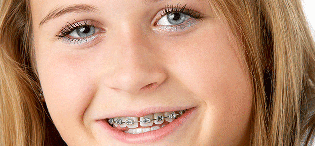 How soon should your pre-teen see the orthodontist?