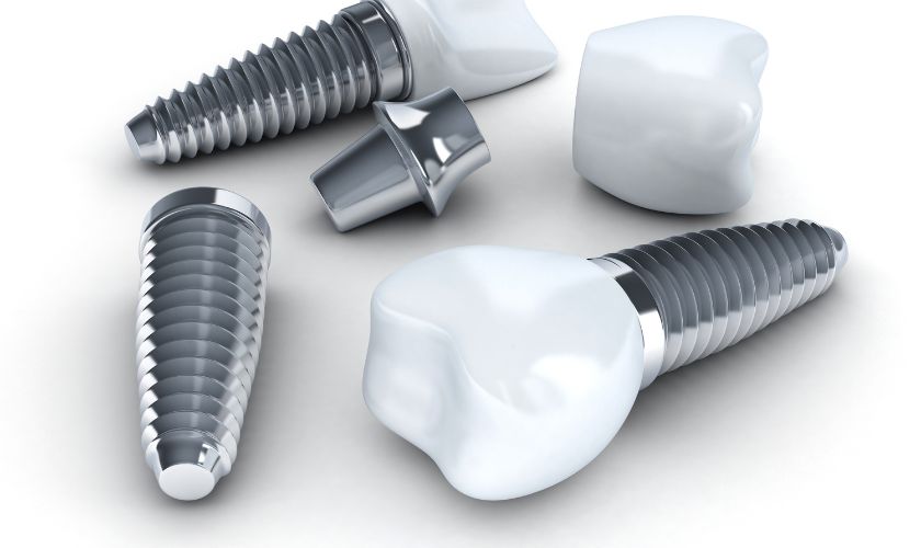 Featured image for “Is it possible to utilize dental implants for repairing fractured teeth?”