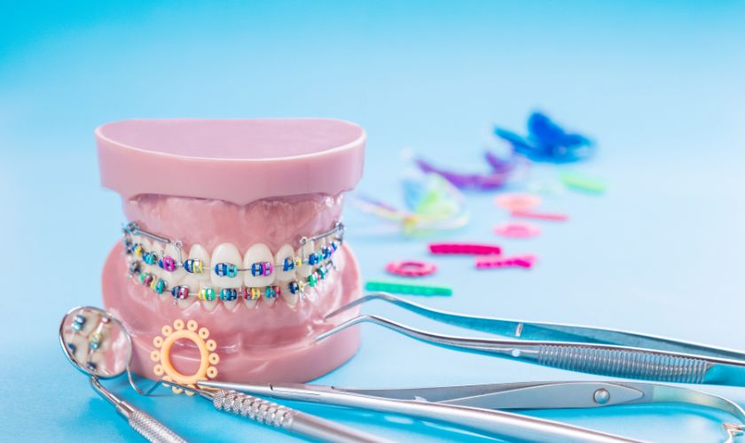 Featured image for “What are the methods of orthodontic treatment?”