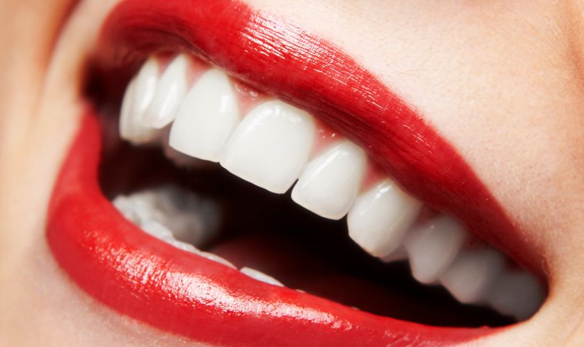 Featured image for “7 Things to Avoid After Teeth Whitening”