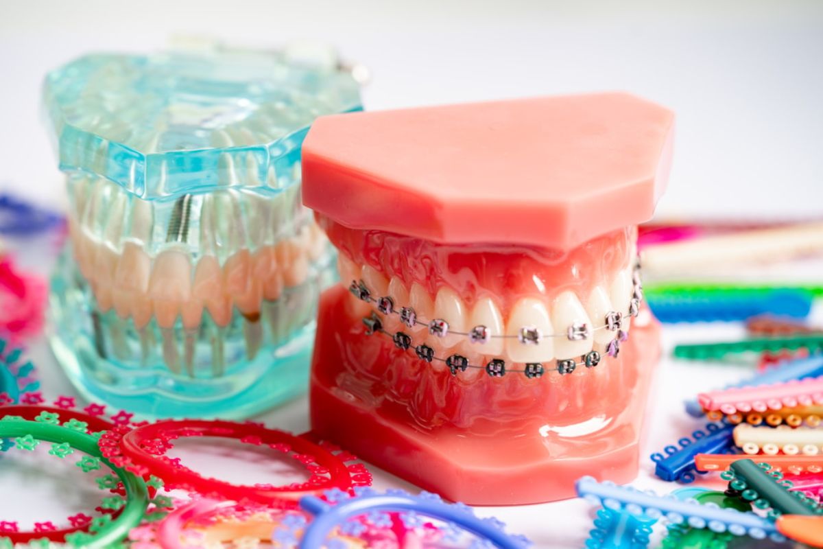 Orthodontic Treatment austin