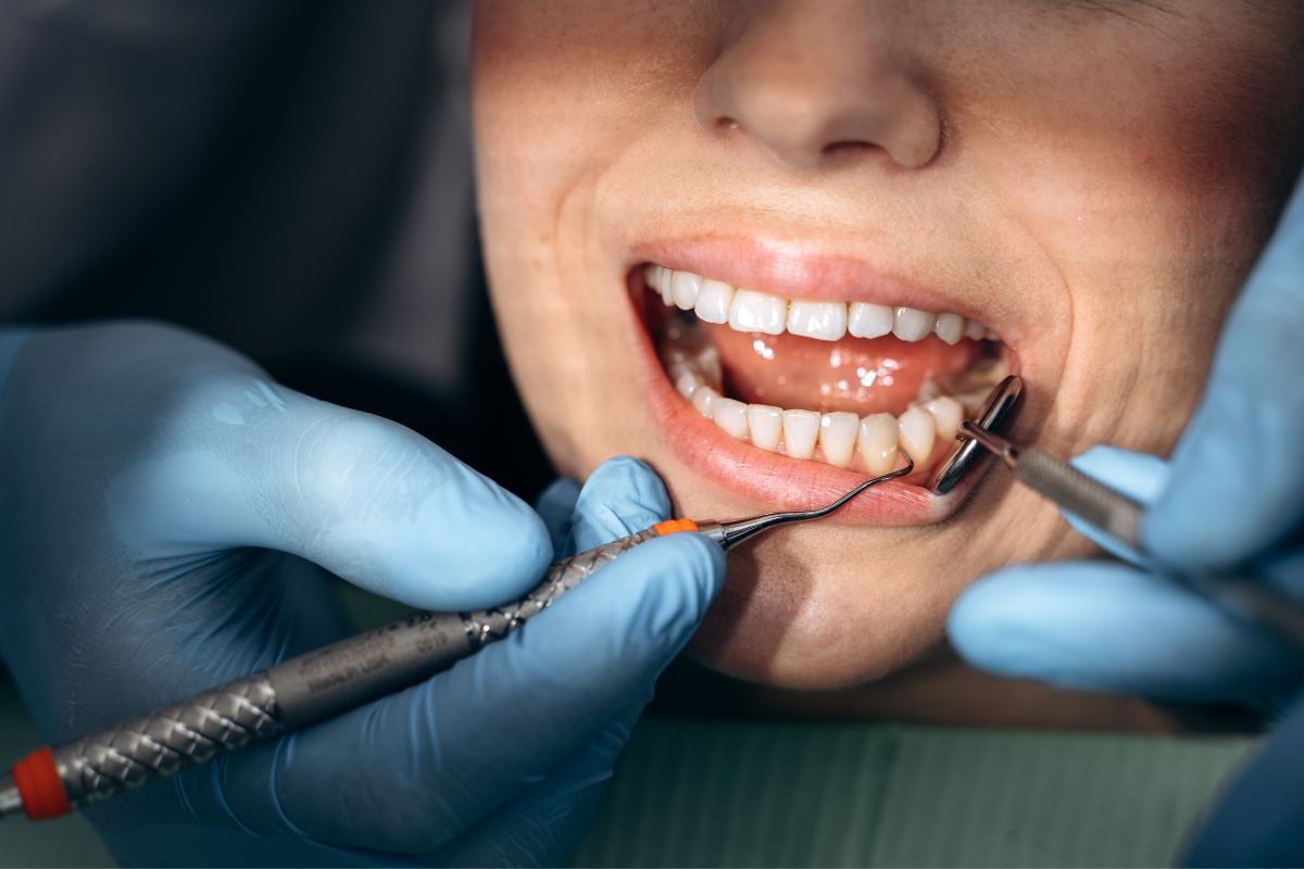 Featured image for “How Can Orthodontic Treatment Improve Crowding, Spacing, and Bite Problems Together?”
